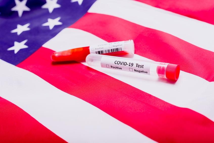 Do Canadians Need a Negative COVID Test to Fly to the U.S.?